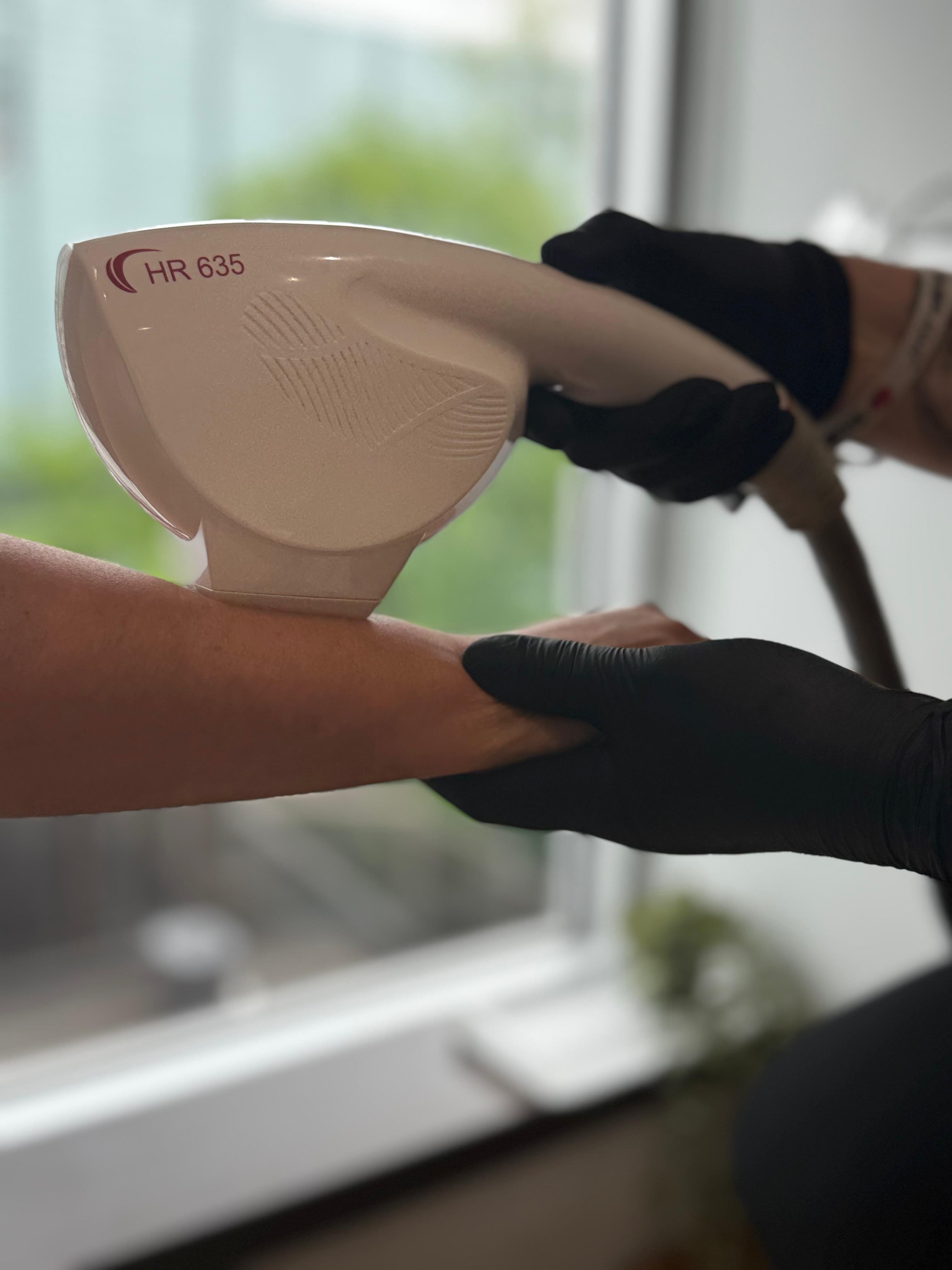 Épilation Laser